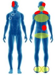 2ヶ月間 毎日あった頭痛がなくなった施術を完全解説！