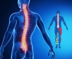 脊柱管狭窄症で痛みが長引く方が“見逃してしまっていること”